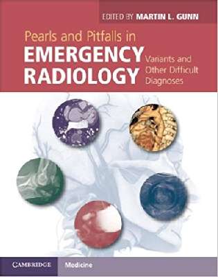 Pearls and Pitfalls in Emergency Radiology: Variants and Other Difficult Diagnoses