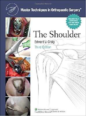 Master Techniques in Orthopaedic Surgery: Shoulder