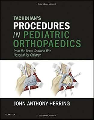 Tachdjian's Procedures in Pediatric Orthopaedics