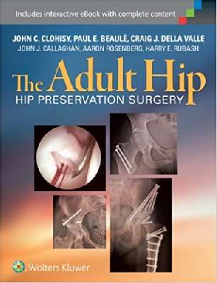 The Adult Hip: Hip Preservation Surgery