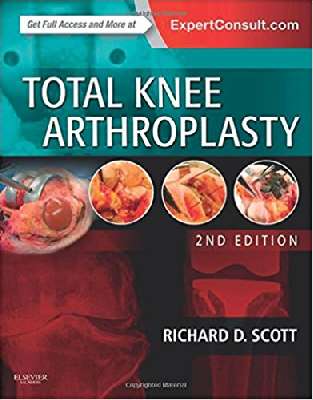 Total Knee Arthroplasty