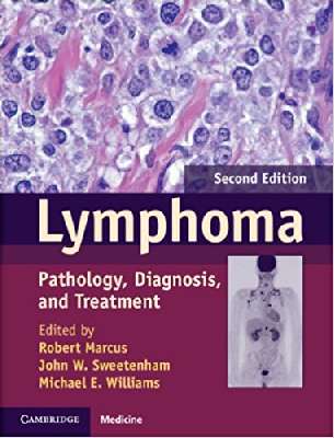 Lymphoma Pathology, Diagnosis, and Treatment 
