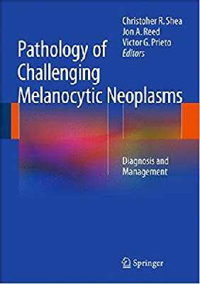 Pathology of Challenging Melanocytic Neoplasms 