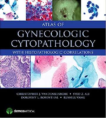 Atlas of Gynecologic Cytopathology : with Histopathologic Correlations