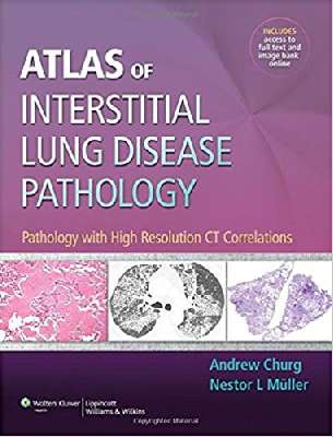 Atlas of Interstitial Lung Disease Pathology: Pathology with High Resolution CT Correlations
