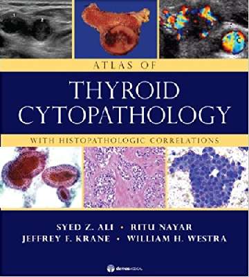 Atlas of Thyroid Cytopathology: With Histopathologic Correlations