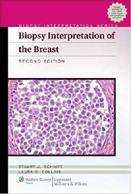 Biopsy Interpretation of the Breast (Biopsy Interpretation Series)