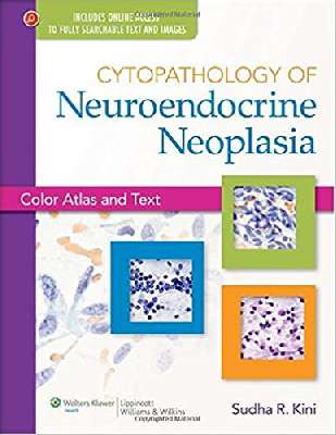 Cytopathology of Neuroendocrine Neoplasia: Color Atlas and Text