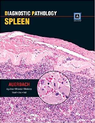 Diagnostic Pathology: Spleen: Published by Amirsys