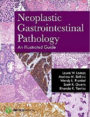 Neoplastic Gastrointestinal Pathology