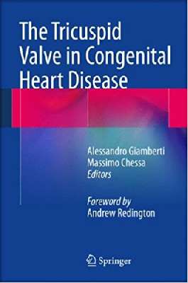 The Tricuspid Valve in Congenital Heart Disease    