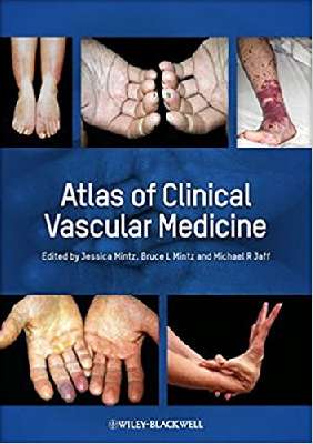 Atlas of clinical Vascular Medicine