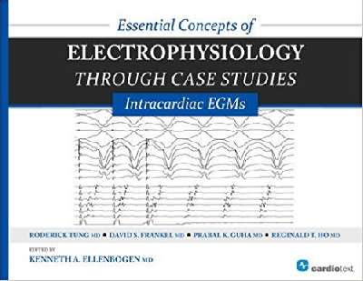 ESSENTIAL CONCEPTS  OF ELECTROPHYSIOLOGY  THROUGH CASE STUDIES:  INTRACARDIAC EGMS