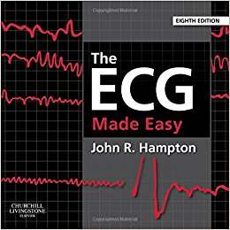 The ECG made Easy