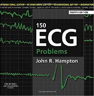 150ECG Problem 