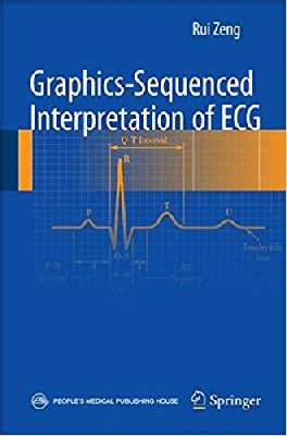 Graphics-Sequenced Interpretation of ECG