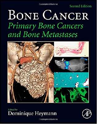 BONE CANCER