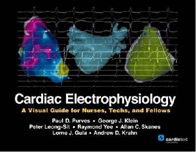 Cardiac Electrophysiology: A Visual Guide for Nurses, Techs, and Fellows