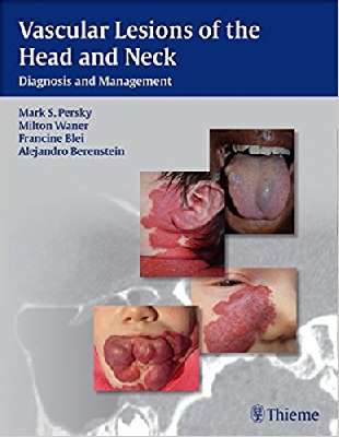 Vascular Lesions of the Head and Neck