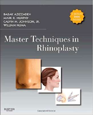 Master Techniques in Rhinoplasty 