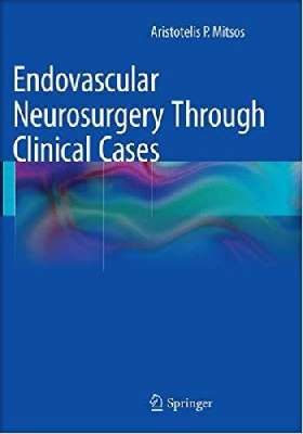 Endovascular Neurosurgery Through Clinical Cases    