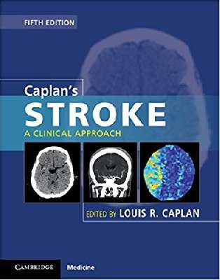 Caplan's Stroke: A Clinical Approach