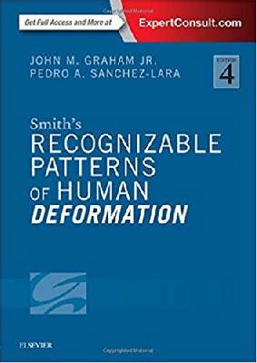 Smith's Recognizable Patterns of Human Deformation