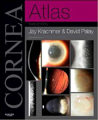 Atlas Cornea 