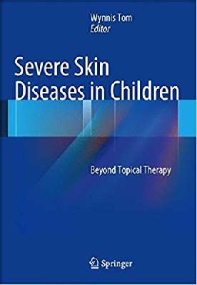 Severe Skin Diseases in Children: Beyond Topical Therapy
