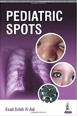 Pediatric Spots