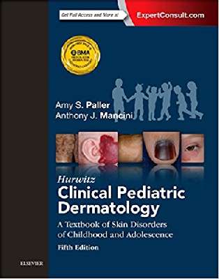 Hurwitz Clinical Pediatric Dermatology: A Textbook of Skin Disorders of Childhood and Adolescence