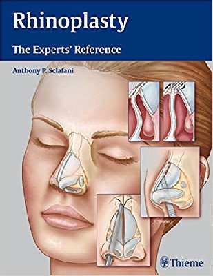 Rhinoplasty The Experts' Reference	