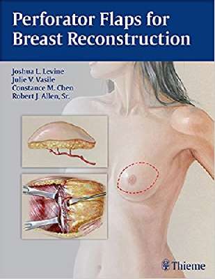 Perforator Flaps for Breast Reconstruction