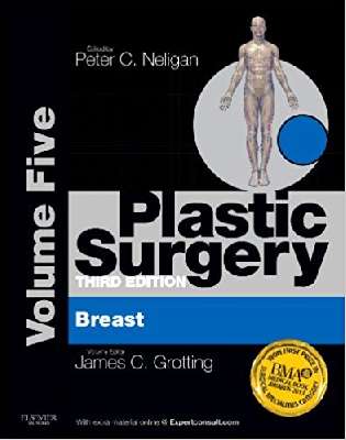 Plastic Surgery: Volume 5: Breast 