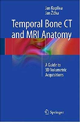 Temporal Bone CT and MRI Anatomy