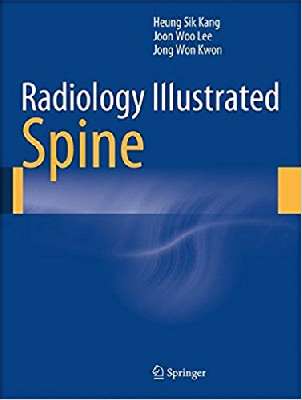 Radiology Illustrated: Spine             