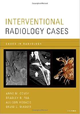 Interventional Radiology Cases