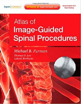 Atlas of of of image Guided Spinal Procedures