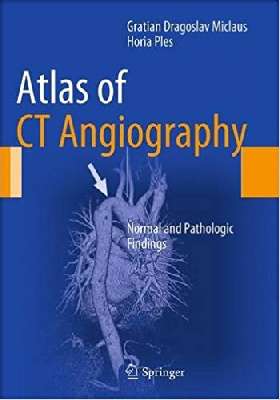 Atlas of CT Angiography: Normal and Pathologic Findings