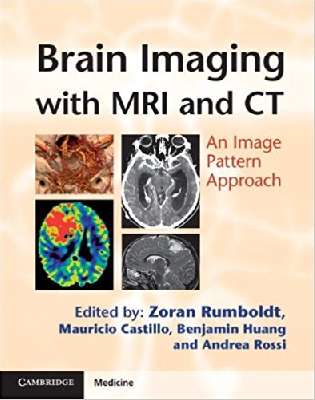 Brain Imaging with MRI and CT: An Image Pattern Approach (Cambridge Medicine (Hardcover))