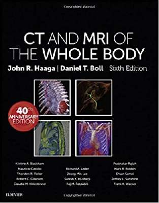 CT and MRI of the Whole Body 3Vol