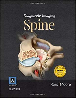 Diagnostic Imaging: Spine