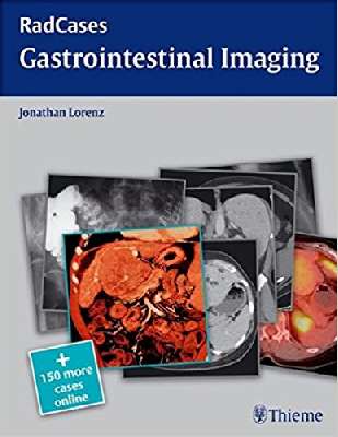 Radcases Gastrointestinal Imaging