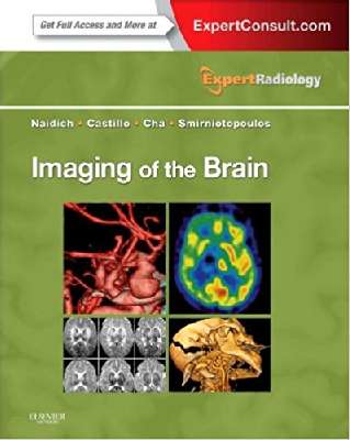 Imaging of the Brain