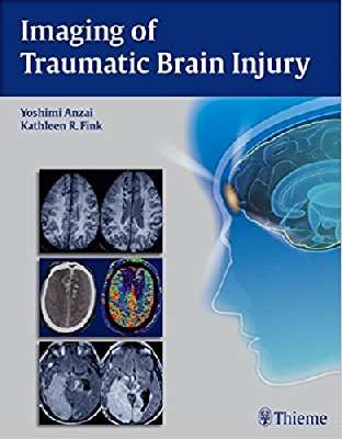 Imaging of Traumatic Brain Injury