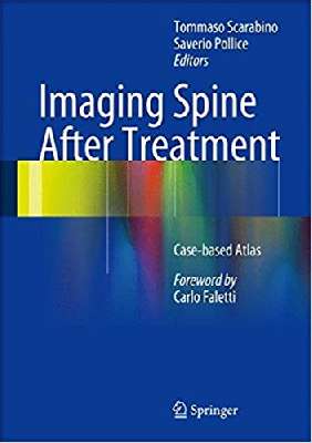 Imaging Spine After Treatment