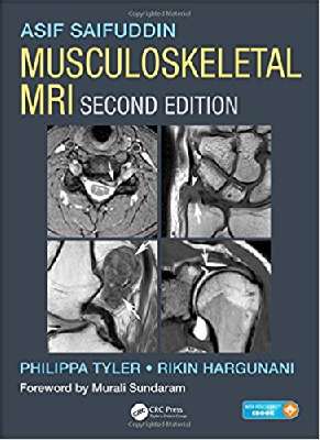 Musculoskeletal MRI 2 Vol