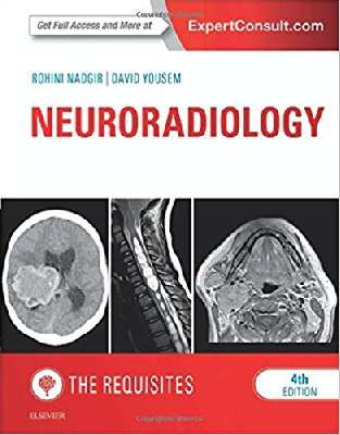 Neuroradiology: The Requisites