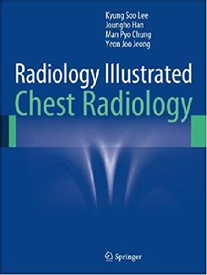 Radiology Illustrated: Chest Radiology