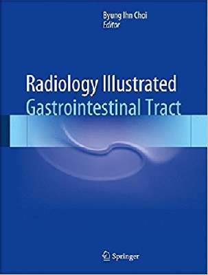 Radiology Illustrated: Gastrointestinal Tract